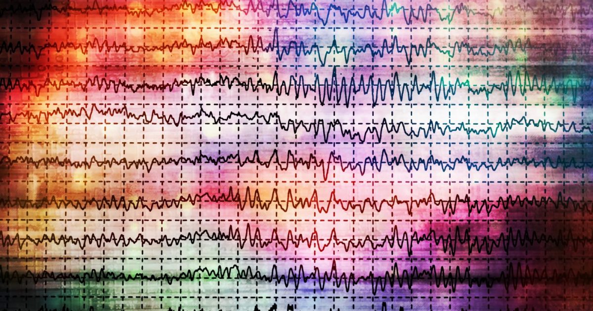 Three Cases of Spinal Muscular Atrophy Associated With