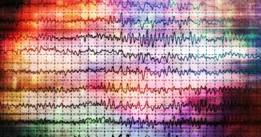 Epilepsy
