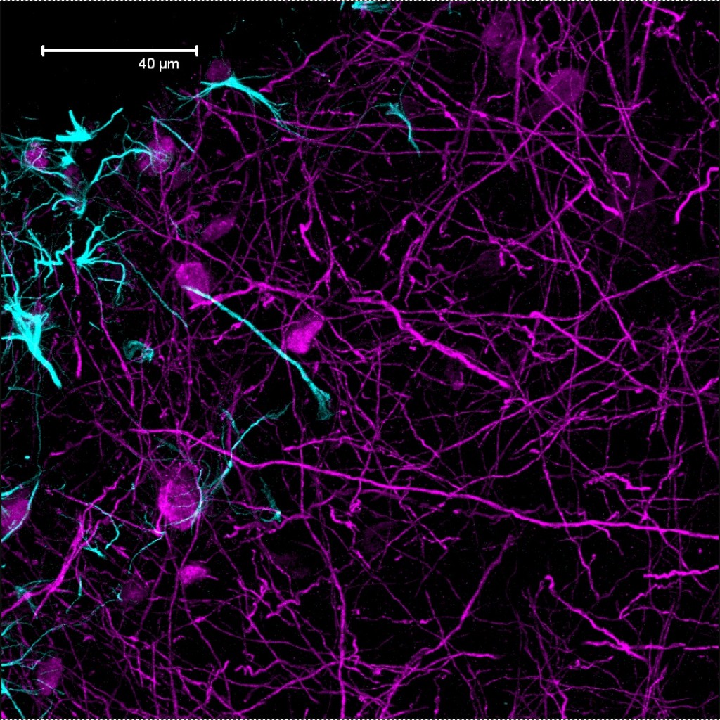 cure sma supports research directed at02restoring smn