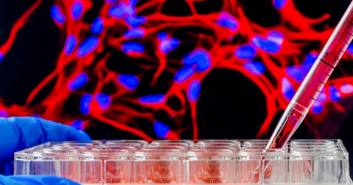 SMA Cell Therapy May Gain with Steps Stem Cells Take to Become Neurons ...