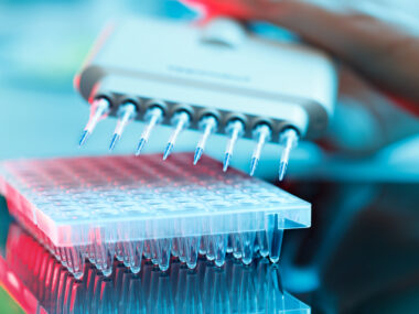 Spinraza and CSF changes