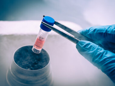 SMA gene identification