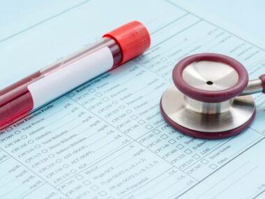 bacterial or viral pneumonia