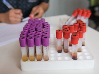 SMN blood test