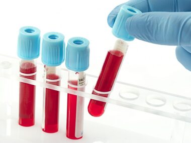 North Carolina newborn screening