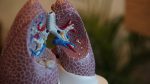 Spinraza | SMA News Today | Treatments | Plastic model of lungs