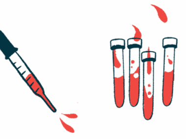 Blood is shown in vials and in a pipette.