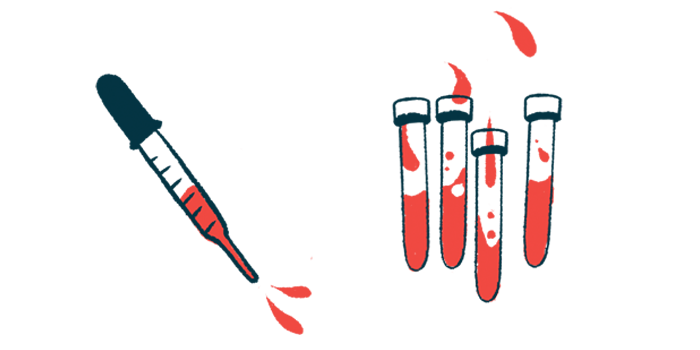Blood is shown in vials and in a pipette.