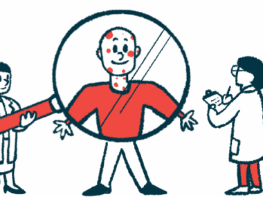 A person in a white coat writes on a clipboard while another person holds a giant magnifying glass up to a patient with red spots on the face and neck.