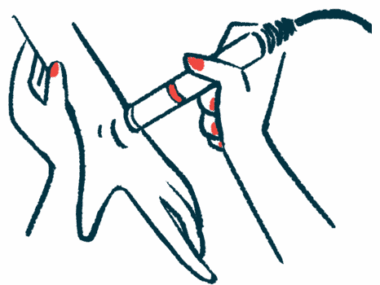 muscle fasciculations | SMA News Today | hand therapy illustration