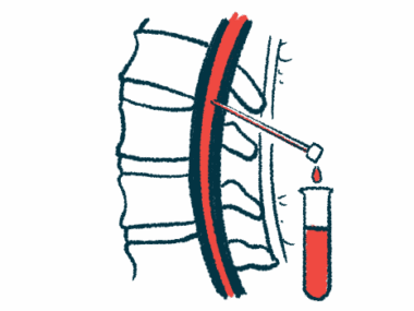 An illustration shows a spinal tap procedure.