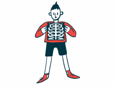 A child is shown holding up a chest X-ray with both hands.