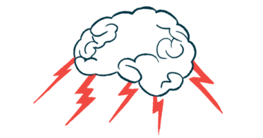 A brain is shown with five lightning bolts coming out of it.