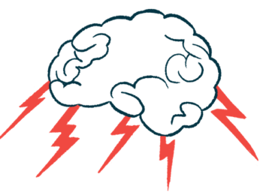 A brain is shown with five lightning bolts coming out of it.