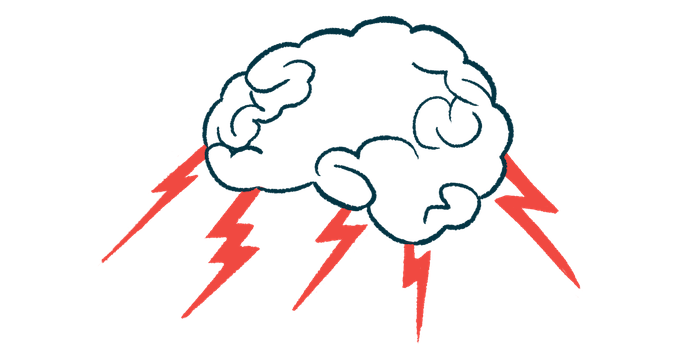 A brain is shown with five lightning bolts coming out of it.
