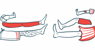 An assortment of supine legs are shown.