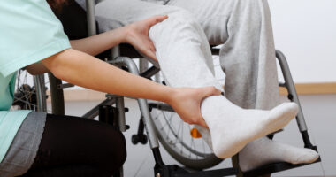 Physical therapist working on the leg of a patient in a wheelchair.