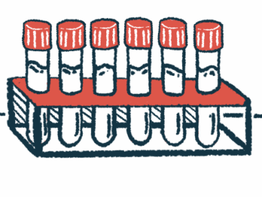 A half-dozen vials with caps on them stand upright in a holder.