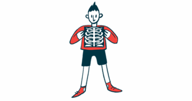 A person uses both hands to hold at chest level an X-ray showing the spine and rib cage.