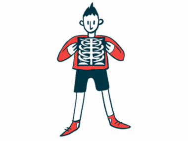 A person uses both hands to hold at chest level an X-ray showing the spine and rib cage.