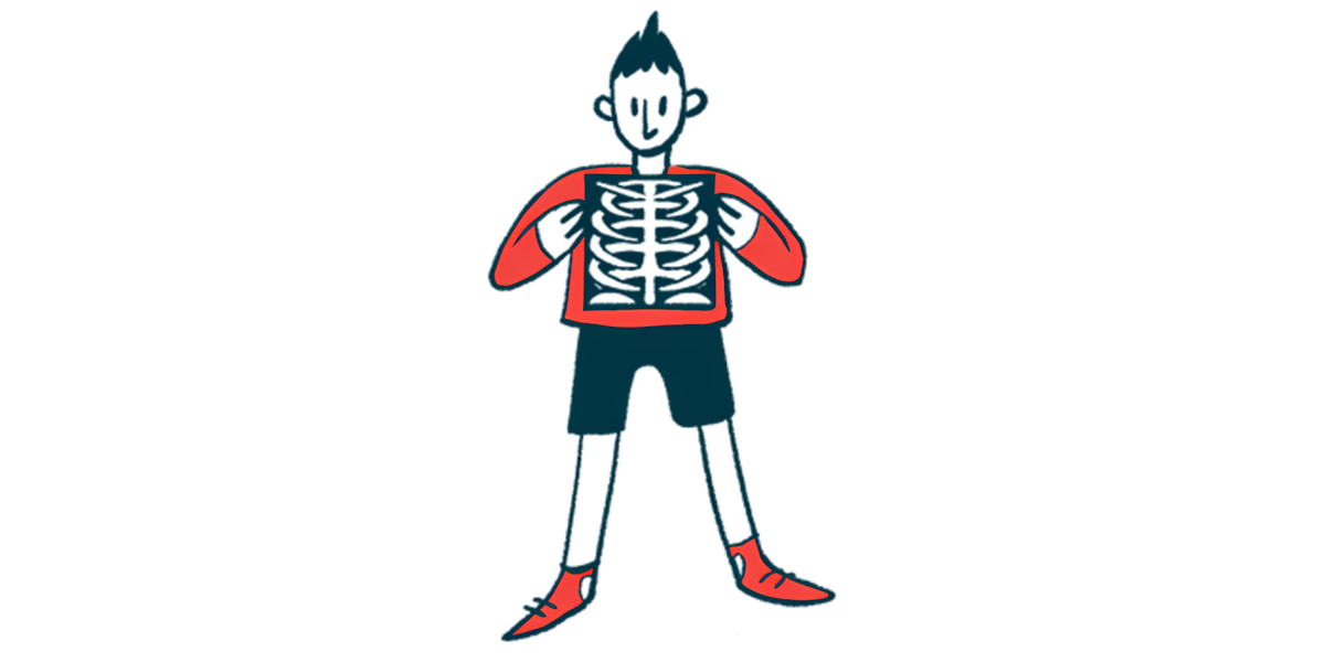 A person uses both hands to hold at chest level an X-ray showing the spine and rib cage.