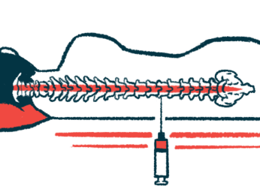 A large syringe with a needle is being used to deliver an injection directly into the spine of a patient lying down, who's seen from the back.