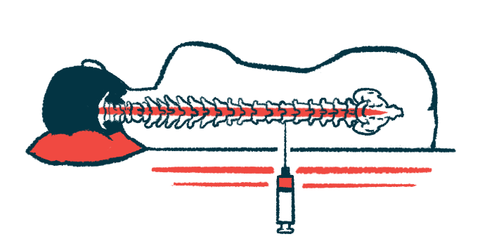 A large syringe with a needle is being used to deliver an injection directly into the spine of a patient lying down, who's seen from the back.